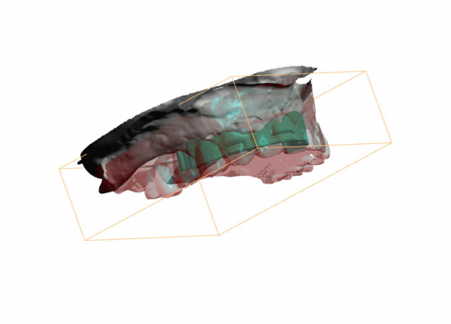 Die 3D-PDF: für eine schnelle Kommunikation zwischen Zahnarzt und Labor
