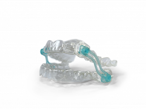 Aligner-Therapie