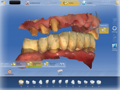 Sirona Software, ZAP Reinstein