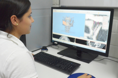 SMOP – 3D Planung, Bohrschablonen und provisorische Kronen